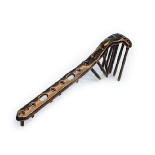 Placca di compressione per tibia - ChM - prossimale / laterale / bloccata
