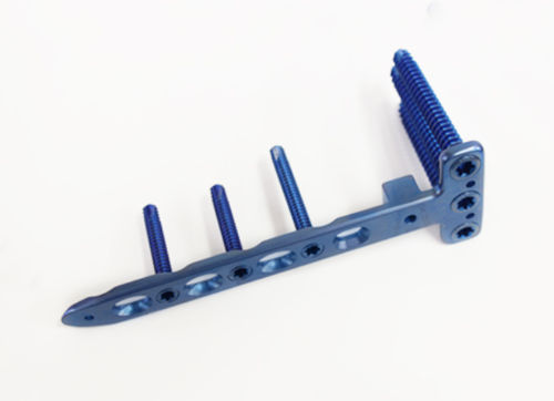 Placca di compressione per epifisi - 3.3538 series - ChM - per femore / distale / bloccata