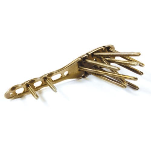 Placca di compressione per omero - 3.4034 series - ChM - prossimale / bloccata / in titanio