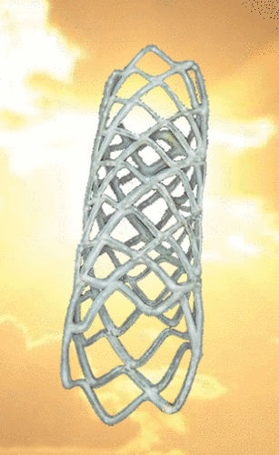 Stent periferico - REMEDY™ - Endocor - in metallo