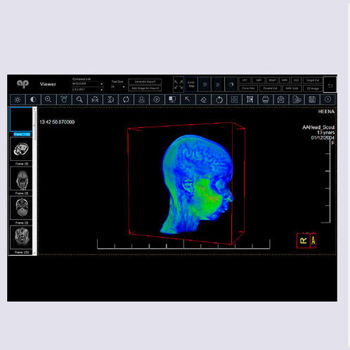 PACS per diagnostica per immagini - Allengers Medical Systems