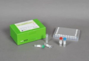Kit di test dell'AIDS - AccuPower® - Bioneer Corporation - per malattie infettive / dell'HIV / di sangue