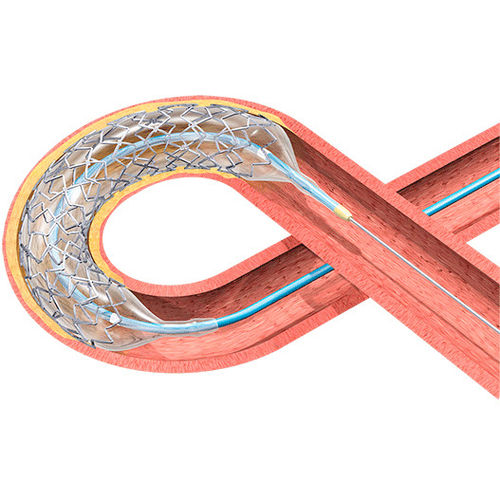 Stent coronarico - BIOMATRIX ALPHA™ - Biosensors International - in cobalto-cromo / per somministrazione di farmaci