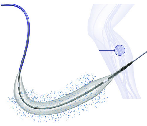 Catetere PTA - BIOPATH™ 014 - Biosensors International - periferico / arterioso / per arteria femorale