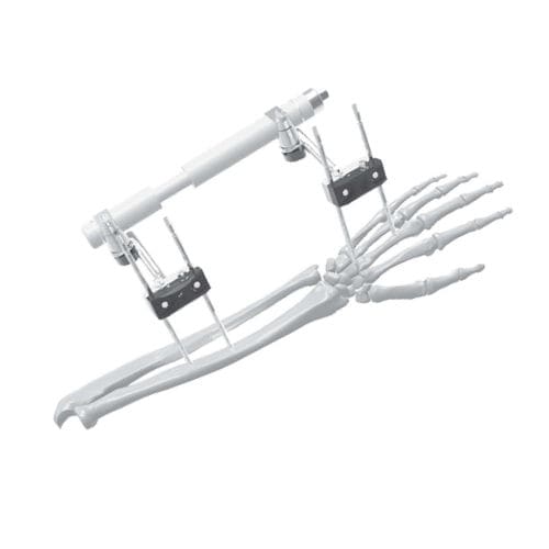 Fissatore esterno per polso - 206315 - SOFEMED International - tubolare / per adulti