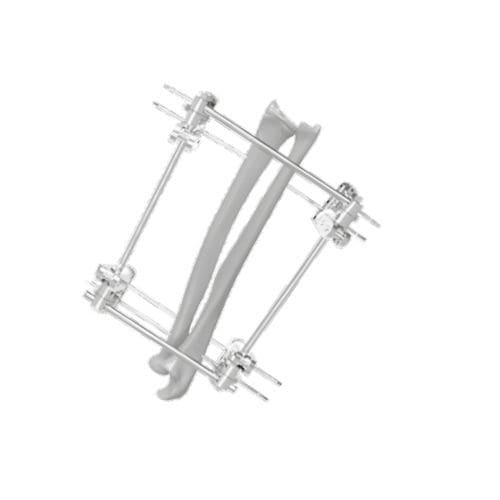 Fissatore esterno per tibia - 201551 - SOFEMED International - per fibula / tubolare / per adulti