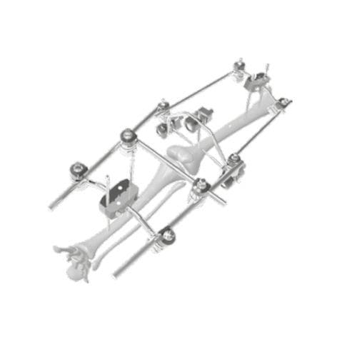 Fissatore esterno per ginocchio - 206310 - SOFEMED International - tubolare / per adulti
