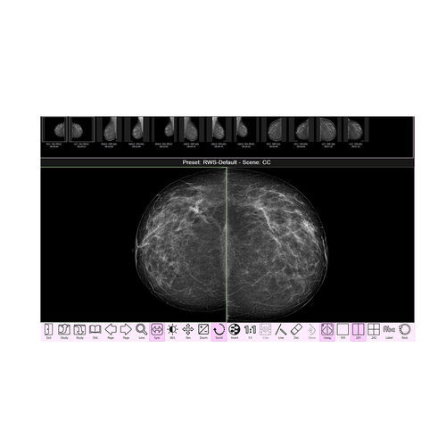 Software clinico - RAFFAELLO  - IMS - per mammografia / di analisi delle immagini / di acquisizione