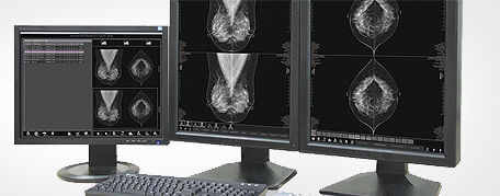 Workstation diagnostica - MammoVU - MEDI-FUTURE - per mammografia