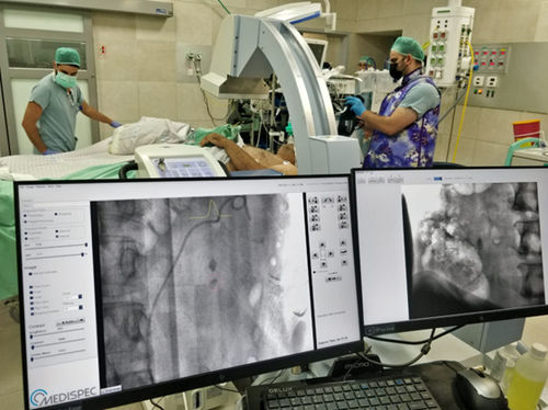 Software di ottimizzazione delle immagini - STONEVISION - Medispec - di controllo / di trattamento / di acquisizione