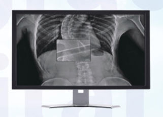 Software di visualizzazione - MADXVIEW - Medonica - per radiologia / per tablet PC