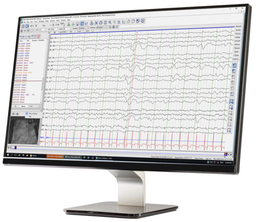 Software di gestione - NeuroWorks® - Natus Medical - di analisi / di condivisione / di monitoraggio