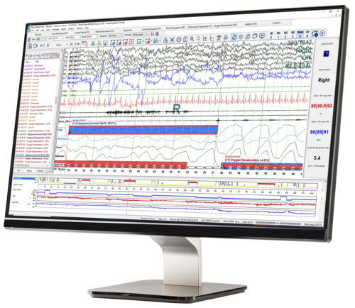 Software di gestione - SleepWorks™ - Natus Medical - di analisi / diagnostico / di trattamento
