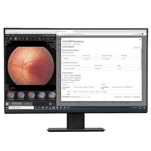 Software di gestione dati - DataLink  - Natus Medical - diagnostico / per reportistica / di scambio dati