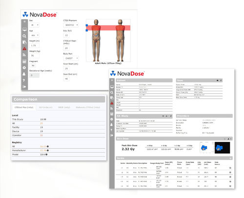 Software di gestione della dose irradiata - NovaDose®  - Novarad - di gestione / clinico / per tomografia computerizzata