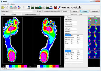 Software per podologia - novel footpat®  - novel - di analisi