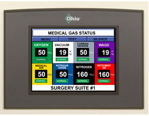Sistema di allarme - Ohio Medical