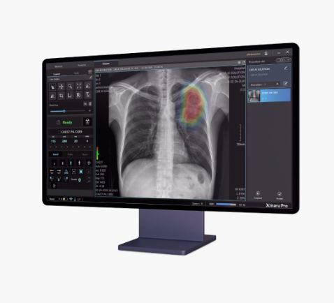 Software medico - Xmaru Pro - Rayence - per radiografia / di gestione dati / visualizzatore