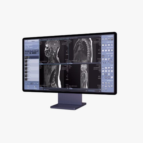 PACS per diagnostica per immagini - Xmaru  - Rayence