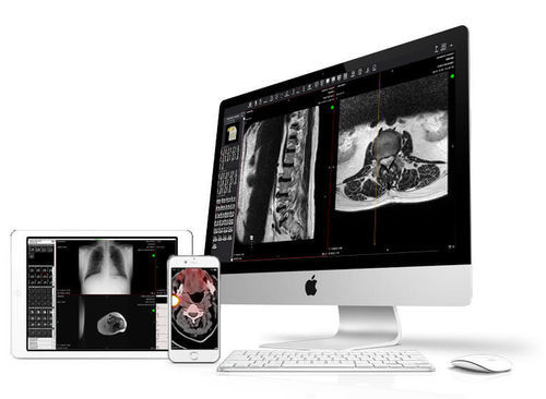 Software medico - Perennity - Rimage EMEA GmbH - per tomografia computerizzata / per radiologia / per reportistica