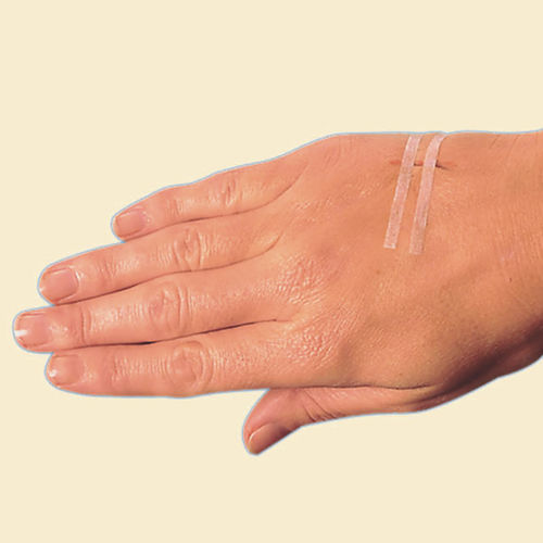 Cerotto per sutura cutanea sterile - SMD-220701 - Suzhou SunMed - in tessuto non tessuto / ipoallergenico
