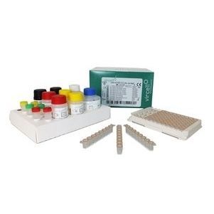 Kit di test per malattie infettive - G/M1004 - Vircell - di globulina / d'IgG / di IgM
