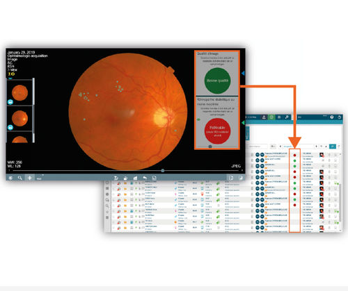 Software per oftalmologia - OphtAI - EVOLUCARE - di gestione / diagnostico / screenin gdella retinopatia diabetica