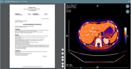 Software visualizzatore - Uview - EVOLUCARE - medico / per radiologia / diagnostico