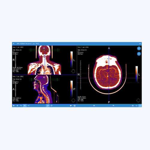 PACS per diagnostica per immagini - EVOLUCARE