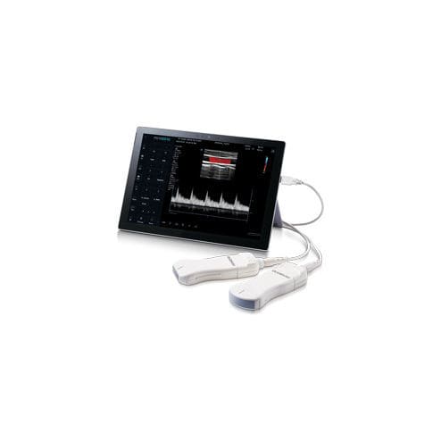 Ecografo palmare - minisono - Alpinion Medical Systems - per ecografia multidisciplinare / in bianco e nero / con doppler a colori