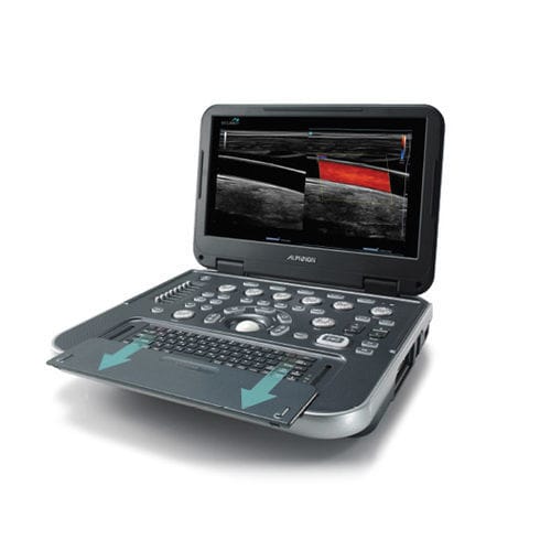 Ecografo portatile - E-CUBE i7 - Alpinion Medical Systems - per ecografia multidisciplinare / con doppler a colori / con console integrata