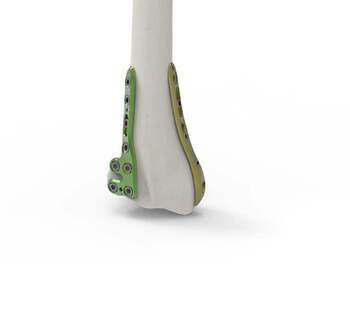 DEBFLEX Meccanico Presa 2P+T: Placca In Alluminio Con Supporto Metallo, Design Moderno