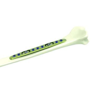 Placca di compressione per radio - ETSIS1 - Newclip Technics - per ulna / mediale / bloccata