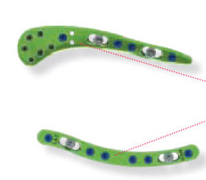 Placca di compressione per clavicola - CBTGLN1 - Newclip Technics - laterale / mediale / bloccata