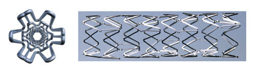 Stent periferico - ProStar - Vascular Concepts