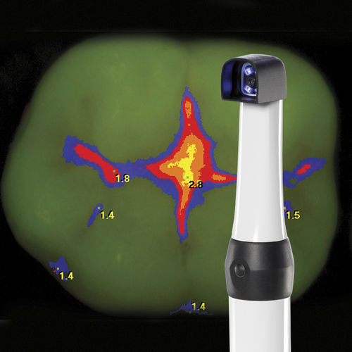 Fotocamera intraorale - CamX Spectra - Air Techniques - digitale / a lampada fluorescente