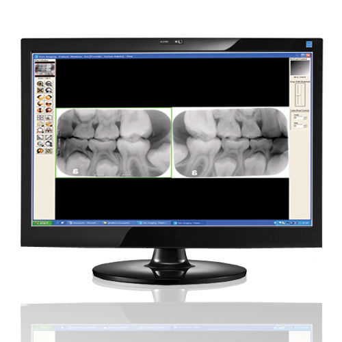 Software per imaging odontoiatrico - Visix® - Air Techniques