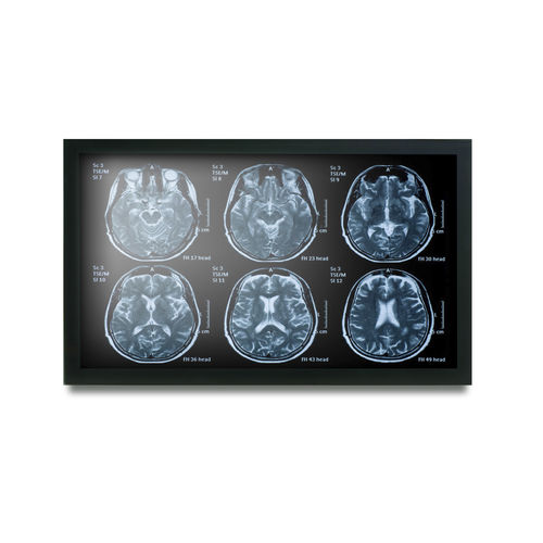 Monitor medico - MEDDP-622 - Onyx Healthcare Inc - 19" / LCD / con retroilluminazione LED