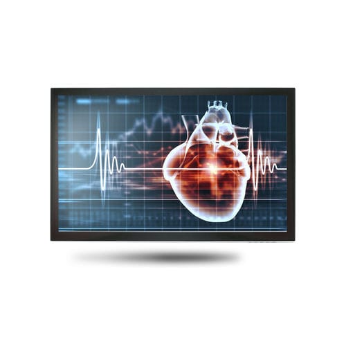 Monitor medico - MEDDP-615 - Onyx Healthcare Inc - 18,5" / LCD / con retroilluminazione LED