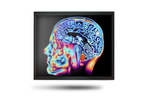 Monitor medico - MEDDP-415 - Onyx Healthcare Inc - 17" / LCD / con retroilluminazione LED