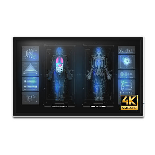 Monitor medico - MEDDP-632 - Onyx Healthcare Inc - 4K / 32" / LCD