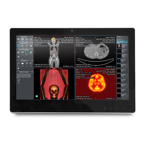 Panel PC medicale Intel® Celeron® - SMA-1533 - Onyx Healthcare Inc - Intel® Atom Dual Core / per reparto di terapia intensiva / per carrelli informatici
