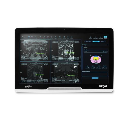 Panel PC medicale Intel® Core i3 - MATE2-2215 - Onyx Healthcare Inc - Intel® Core™ / Intel® Core i5 / Intel® Core i7