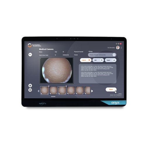 Computer medicale Intel® Core™ - Venus-244 - Onyx Healthcare Inc - Intel® Tiger Lake i3 / Intel® Tiger Lake i5 / TPM Windows 11