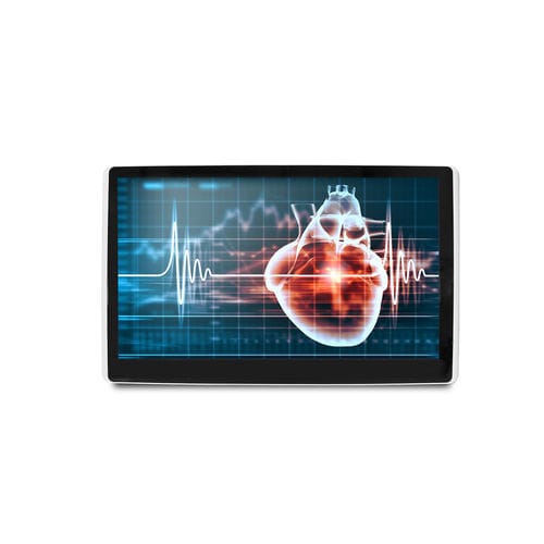 Monitor medico - MEDDP-615 - Onyx Healthcare Inc - 18,5" / LCD / con retroilluminazione LED