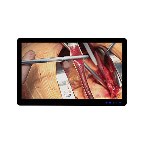 Monitor medico - MSAP5521AMA - Avalue Healthcare - per diagnostica per immagini / chirurgico / 3840 × 2160