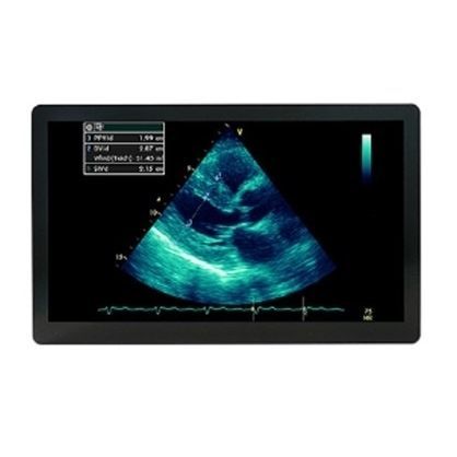 Monitor per ecografia - MSBP2416AMC - Avalue Healthcare - chirurgico / 1920 x 1080 / 24"