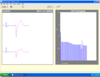 Software medico - Trillium Platinum™ - Forest Medical - per Holter cardiaco / per reportistica / di analisi