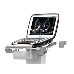 Ecografo portatile con carrello - uSmart® 3300 NexGen  - Terason - per ecografia in anestesia e terapia intensiva / per ecografia in medicina d'emergenza / per ecografia da stress farmacologico