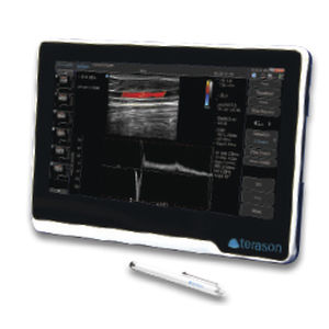 Ecografo portatile - uSmart® 3200T NexGen - Terason - per ecografia in medicina d'emergenza / per ecografia in anestesia e terapia intensiva / in bianco e nero